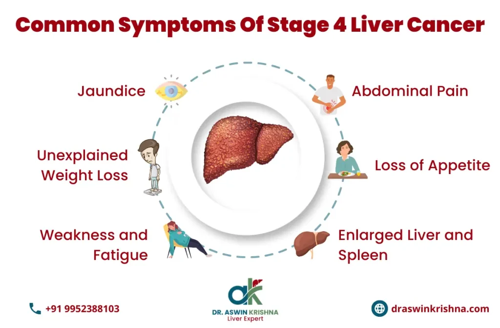 liver cancer treatment in chennai |  Dr. Aswin Krishna