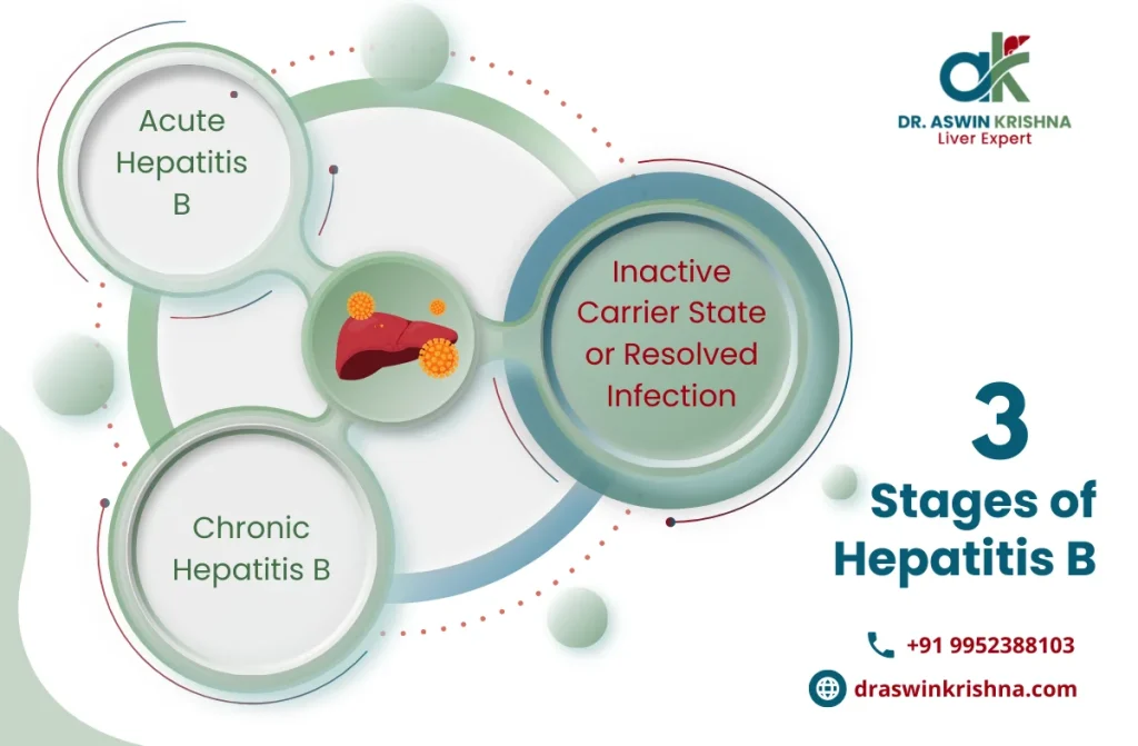 Best Treatment for Hepatitis B in Chennai | Dr. Aswin Krishna