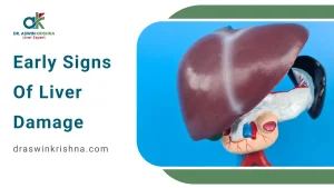 Early Signs of Liver Damage