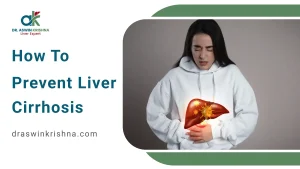 How to Prevent Liver Cirrhosis
