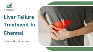 Liver Failure Treatment in Chennai