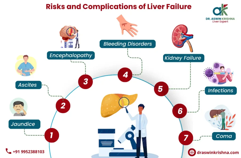 Liver Failure Treatment in Chennai