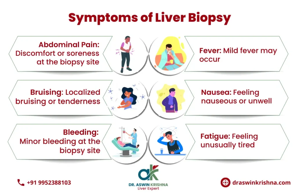 Liver Biopsy in Chennai