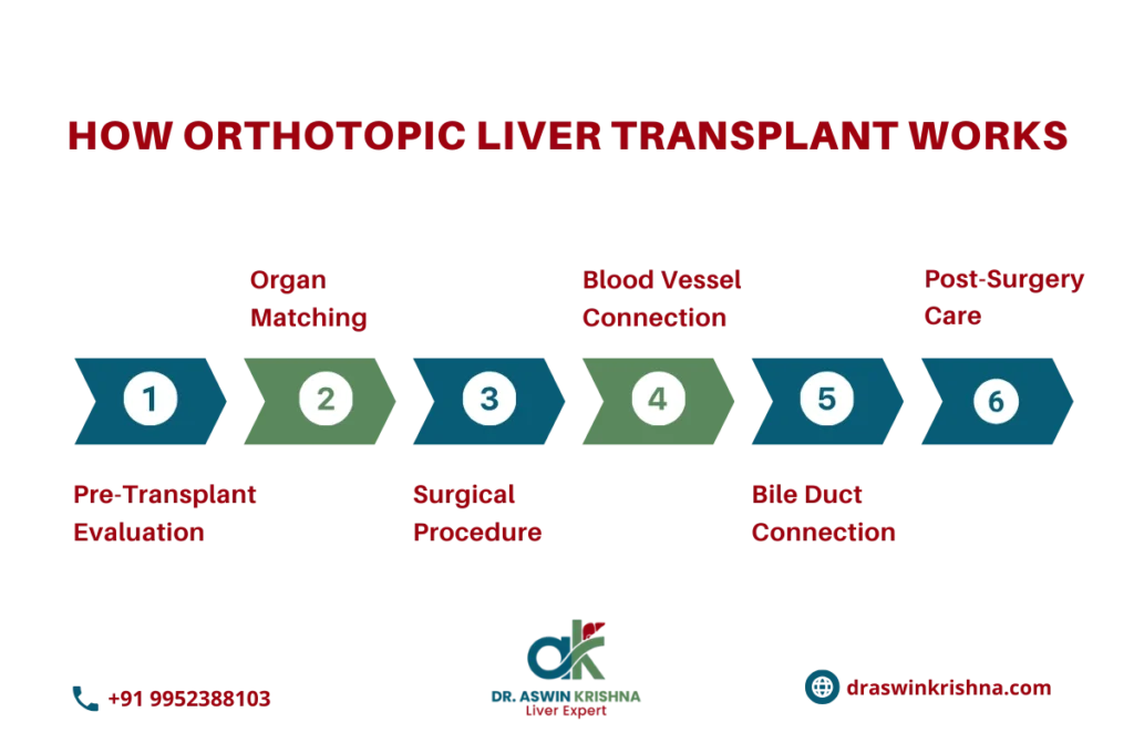 Types of Liver Transplant