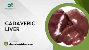 Cadaveric Liver