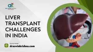 Liver Transplant Challenges In India