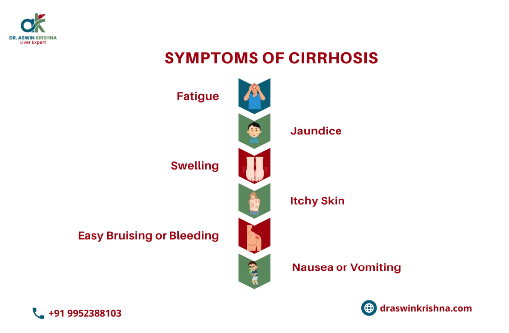 Liver Transplant for Cirrhosis